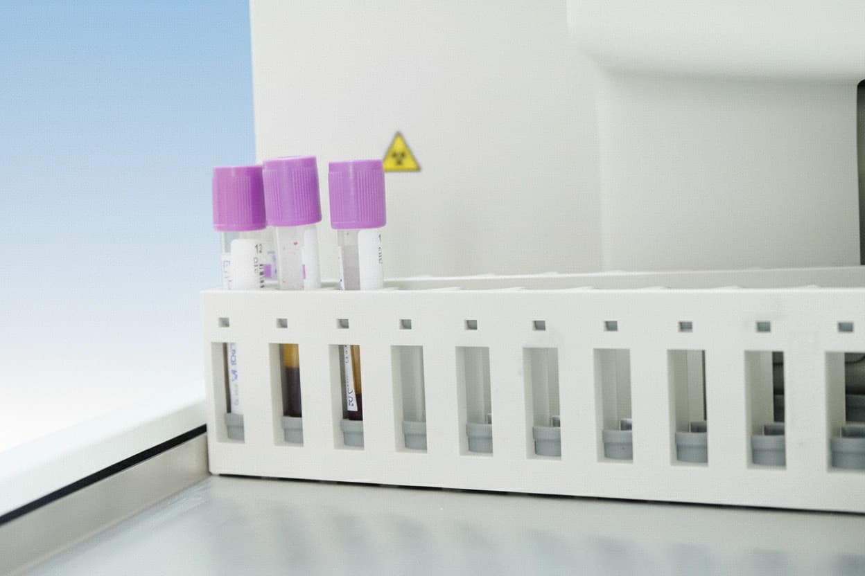 Type 1 Diabetes Diagnosis Process